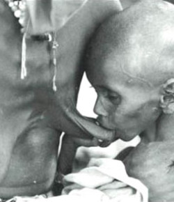 Matar de hambre a Somalia
