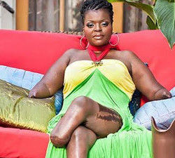Su obsesión por la belleza la condujo a perder sus piernas y nalgas