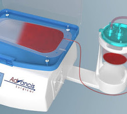 Un invento israelí que recicla la sangre